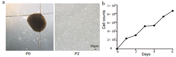 间充质干细胞来源的外泌体通过诱导自噬修复帕金森病模型