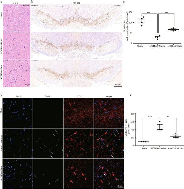间充质干细胞来源的外泌体通过诱导自噬修复帕金森病模型