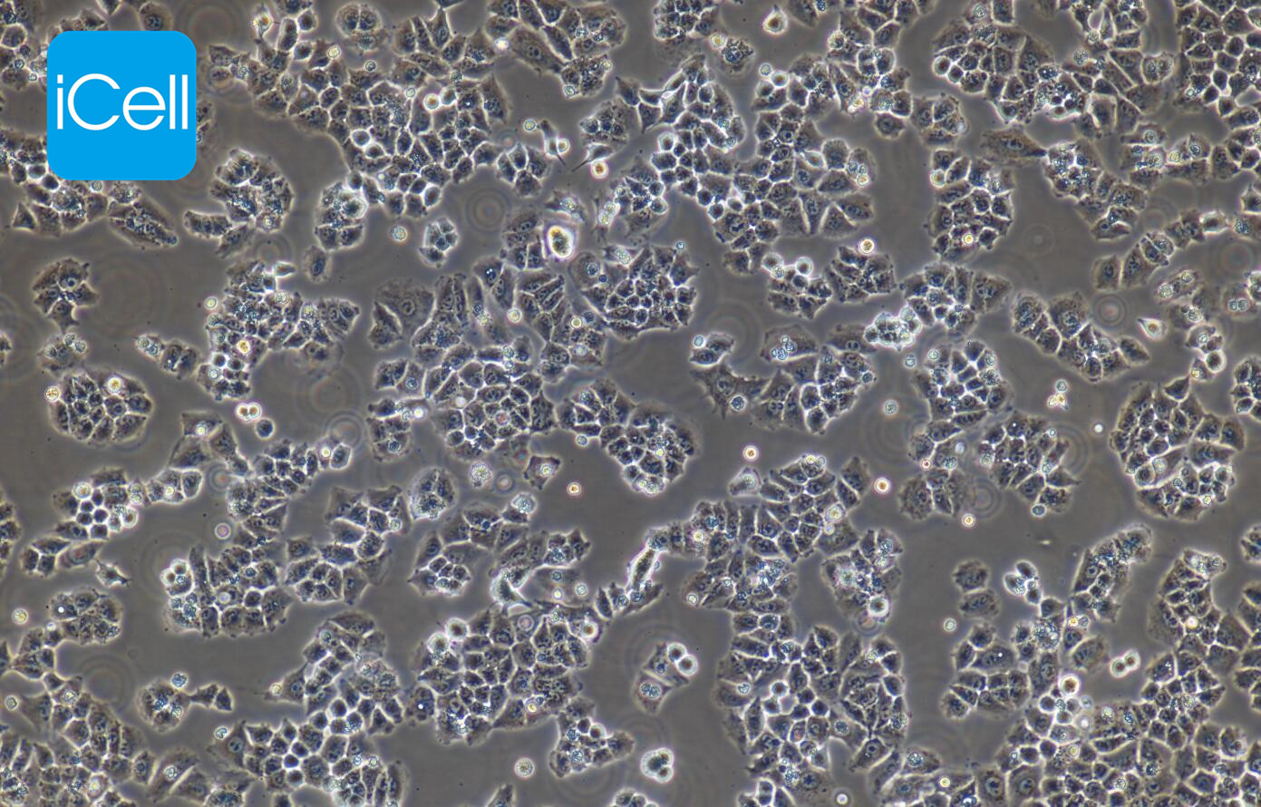 Caov-3人卵巢腺癌细胞/STR鉴定/镜像绮点（Cellverse）