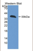 角蛋白13(KRT13）多克隆抗体