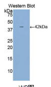 α2-HS糖蛋白(αHSG）多克隆抗体