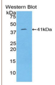 角蛋白8(KRT8）多克隆抗体