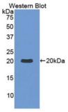 白介素1β(IL1β）多克隆抗体