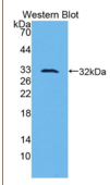 尿激酶型纤溶酶原激活因子(uPA）多克隆抗体