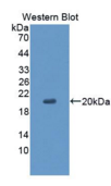 CD99分子(CD）多克隆抗体检测试剂盒99(酶联免疫吸附试验法）多克隆抗体
