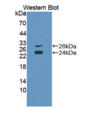CD8a分子(CD8a）多克隆抗体