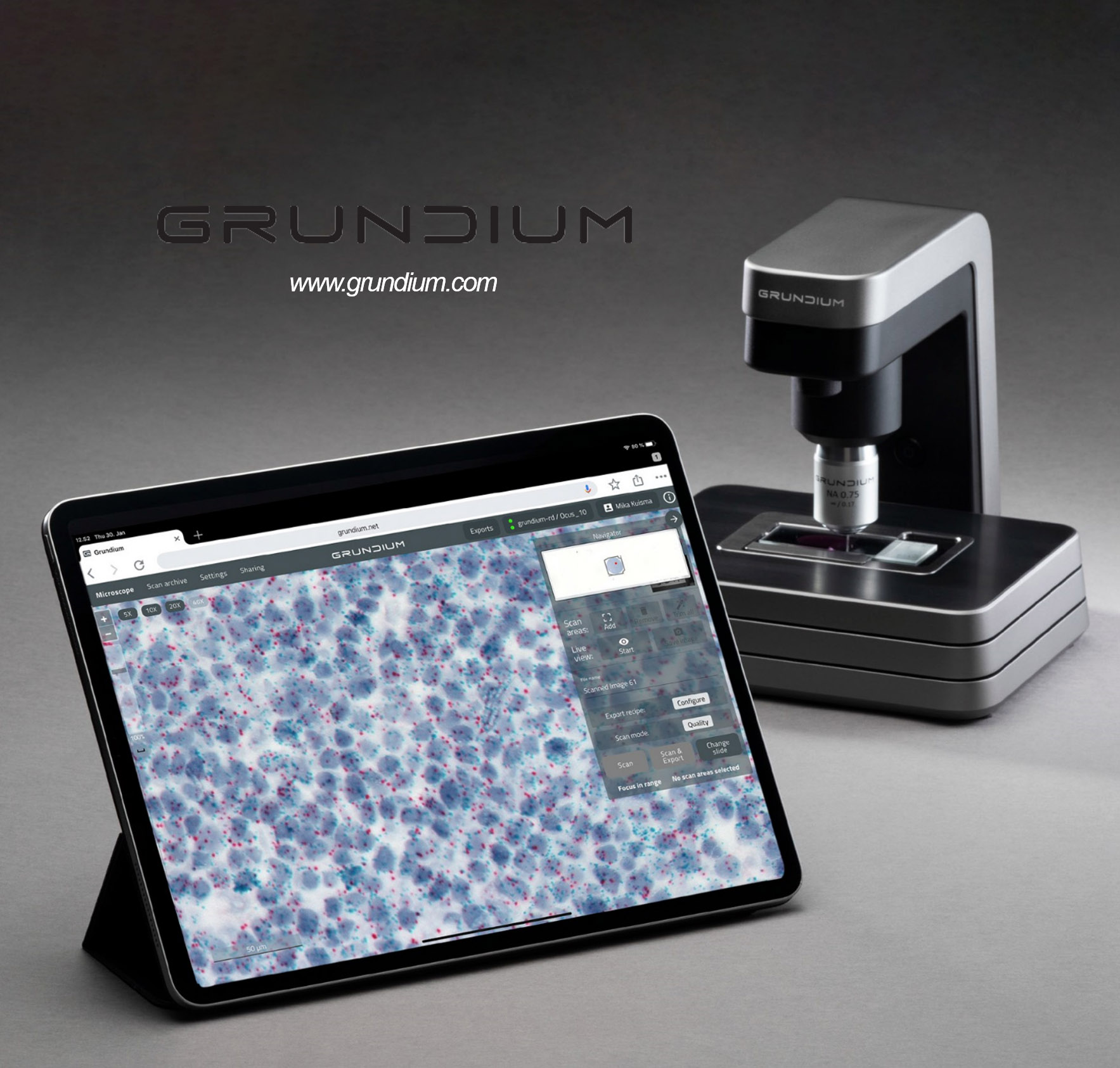 全球首款个人数字病理切片扫描系统诚招区域代理