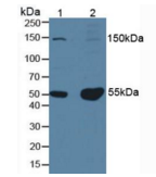 Ⅰ型前胶原氨基端原肽(PⅠNP）多克隆抗体