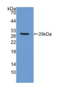 钙非依赖性磷脂酶A2(iPLA2）多克隆抗体