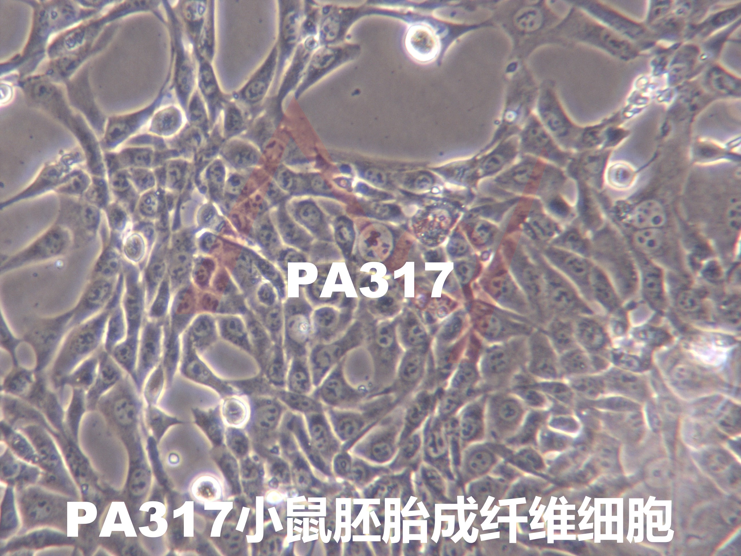 PA317【pA317】小鼠成纤维细胞