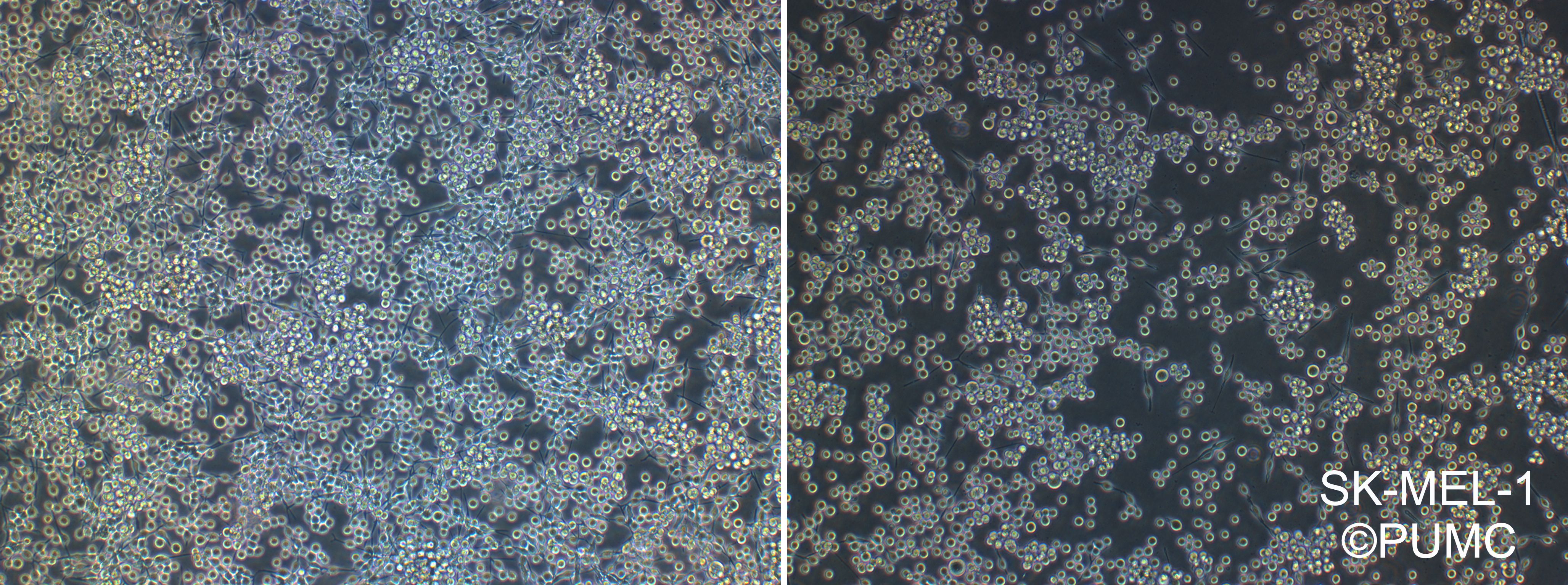 SK-MEL-1【SK-Mel-1; SK Mel 1; S