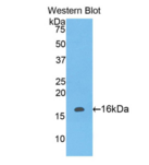白细胞关联免疫球蛋白样受体2(LAIR2）多克隆抗体