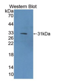 Ⅸ型胶原α1(COL9α1）多克隆抗体