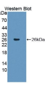 TATA框结合蛋白关联因子12(TAF12）多克隆抗体