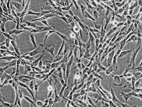 人脑血管外膜成纤维细胞 HBVAF