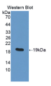 蛋白二硫化物异构酶A5(PDIA5）多克隆抗体