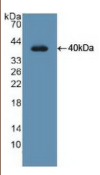 尿嘧啶DNA糖基化酶(UNG）多克隆抗体