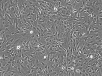 人脑血管平滑肌细胞 HBVSMC