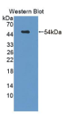 Sestrin2蛋白(SESN2）多克隆抗体