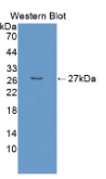 EB病毒诱导蛋白3(EBI3）多克隆抗体