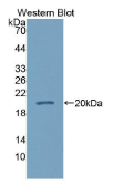 钙调蛋白样蛋白5(CALML5）多克隆抗体