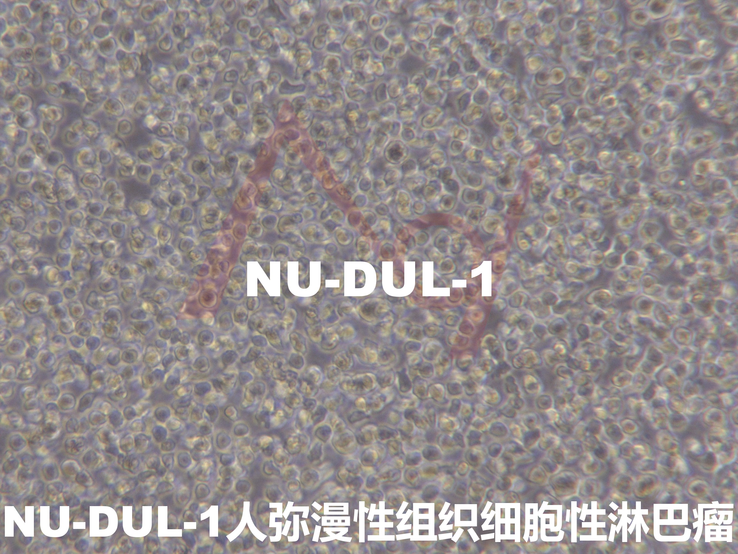 NU-DUL-1【NUDUL-1; NUDUL1】弥漫性组织细胞性淋巴瘤