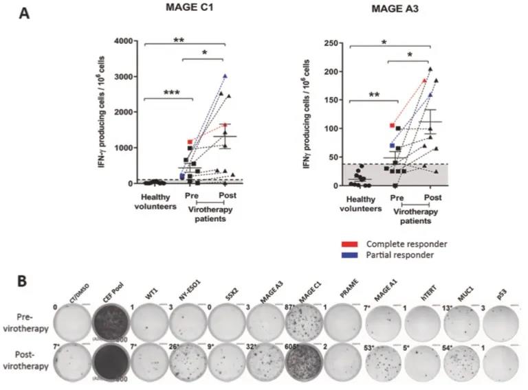 Nature子刊|麻疹溶瘤病毒疗法可增强多发性骨髓瘤患者体内肿瘤抗原特异性T细胞反应
