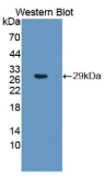 蛋白酶体亚基β6(PSMβ6）多克隆抗体