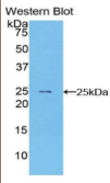 外周鞘磷脂蛋白22(PMP22）多克隆抗体