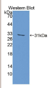 含RNA结合冷休克域蛋白E1(CSDE1）多克隆抗体