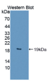 丝织蛋白1(DBN1）多克隆抗体