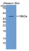 醛脱氢酶3家族成员A1(ALDH3A1）多克隆抗体
