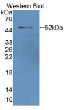 核纤层蛋白A/C(LMNA）多克隆抗体