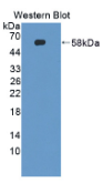 周期素依赖性激酶抑制因子3(CDKN3）多克隆抗体