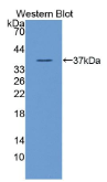 N-myc下游调节基因2(NDRG2）多克隆抗体