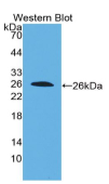 白介素22受体α2(IL22Rα2）多克隆抗体