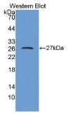 二肽基肽酶6(DPP6）多克隆抗体