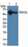 白介素6受体(IL6R）多克隆抗体