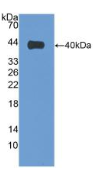 绒毛蛋白1(VIL1）多克隆抗体