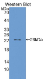 细胞色素P450家族成员2E1(CYP2E1）多克隆抗体