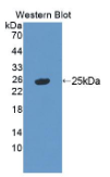 Rho鸟嘌呤核苷酸交换因子7(ARHGEF7）多克隆抗体