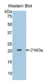 蛋白酶3(PR3）多克隆抗体