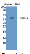 肽基精氨酸脱亚氨酶Ⅳ(PADI4）多克隆抗体