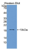 白介素3受体α(IL3Rα）多克隆抗体