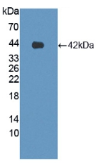 蛛毒素受体3(LPHN3）多克隆抗体