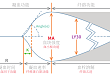 血栓弹力图在围术期凝血管理方面的应用