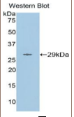 基质金属蛋白酶16(MMP16）多克隆抗体