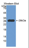 组氨酸脱羧酶(HDC）多克隆抗体
