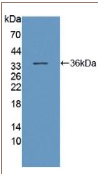 动力蛋白轴丝重链11(DNAH11）多克隆抗体