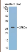卷曲同源物1(FZD1）多克隆抗体